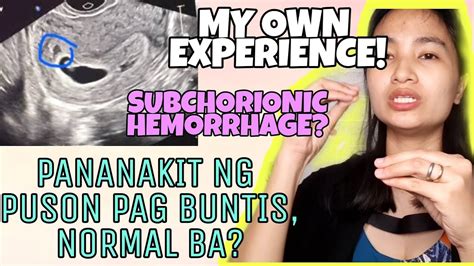 bakit kumikirot ang dede|Pananakit Ng Balakang At Puson: 10 Na Posibleng .